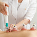 Six different sizes of cupping therapy tools laid out for versatile application.